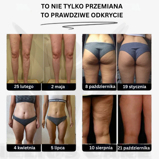 BodyFit™ – Legginsy 3D modelujące